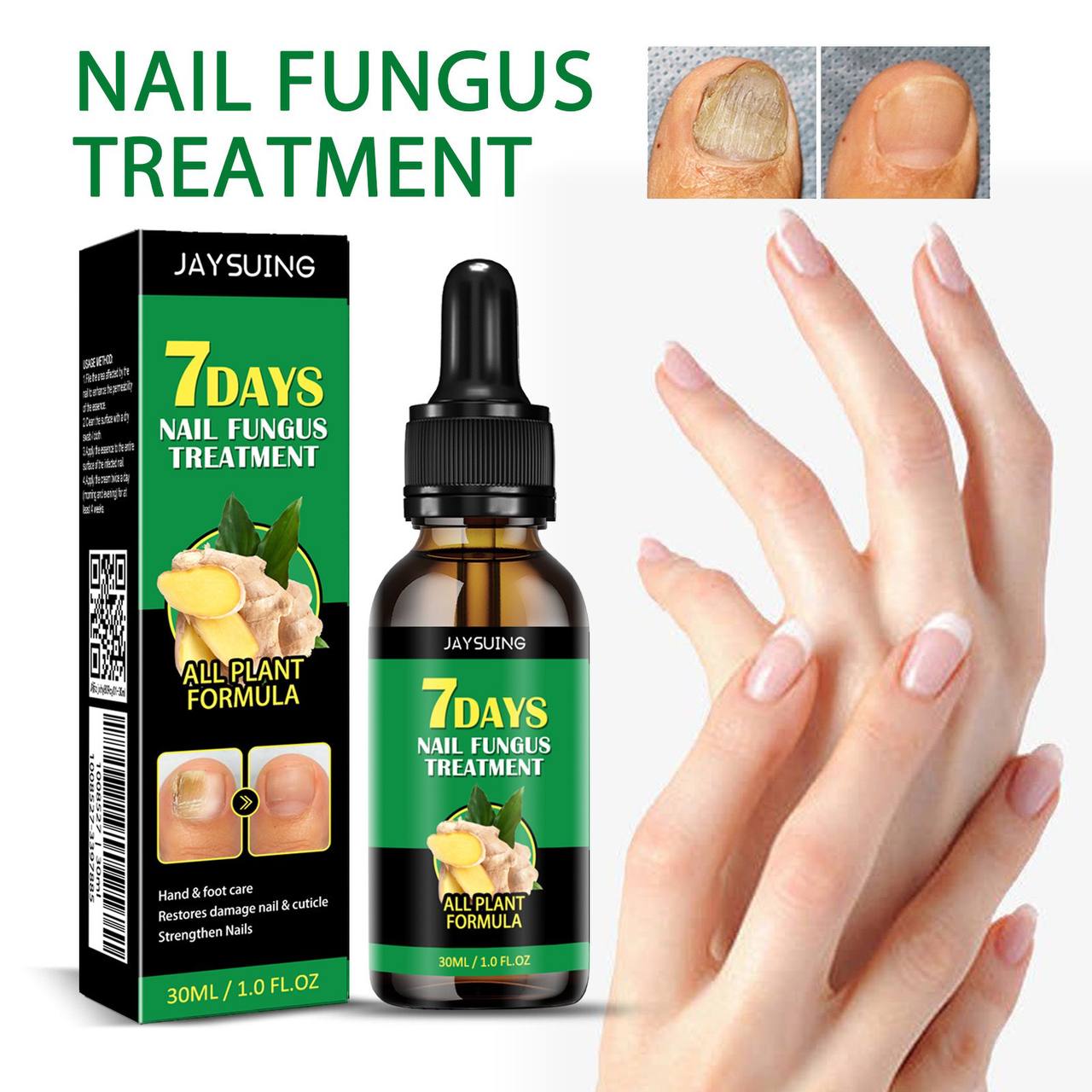 Répare Ongles – Traitement Puissant Anti-Mycose pour des Ongles Sains