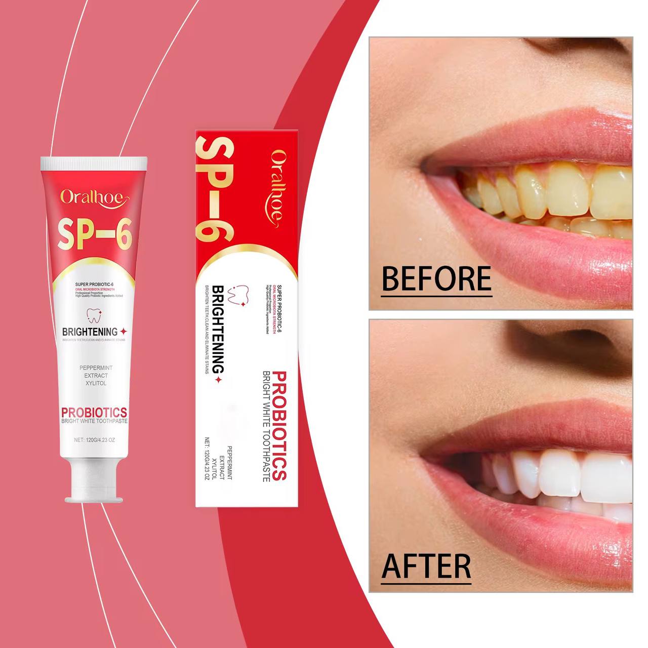 SP-6 Dentifrice Probiotique Blanchissant